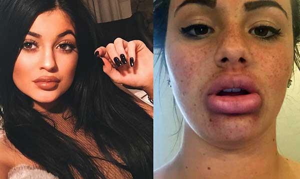 Подростки используют рюмки на губах для Kylie Jenner Challenge